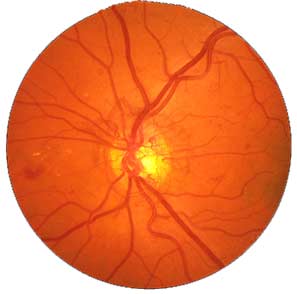 Retina